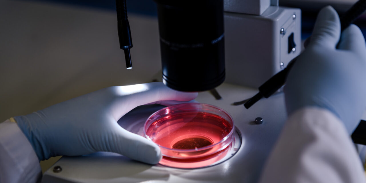 Una terapia con ingeniería genética podría evitar las complicaciones más graves del tratamiento de la leucemia