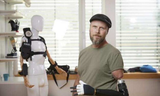 Control sin precedentes en cada dedo de una mano biónica gracias a un avance de la cirugía